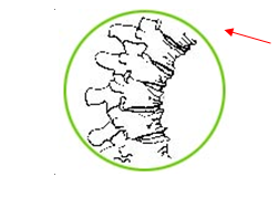 osteoporoza 1000